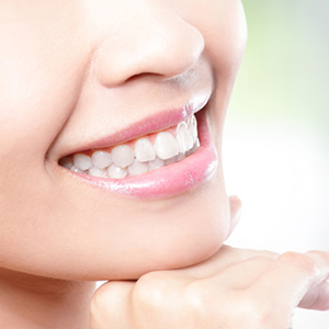 dentalesthetic01